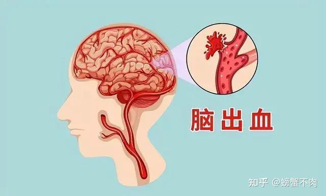 高血压的危害你注意了吗？